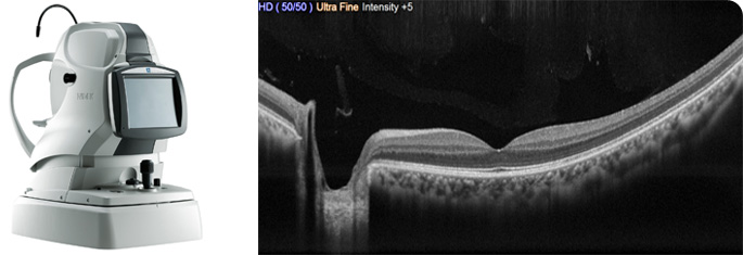 Optical Coherence Tomographer Optical Coherence Tomographer